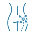 sciatica